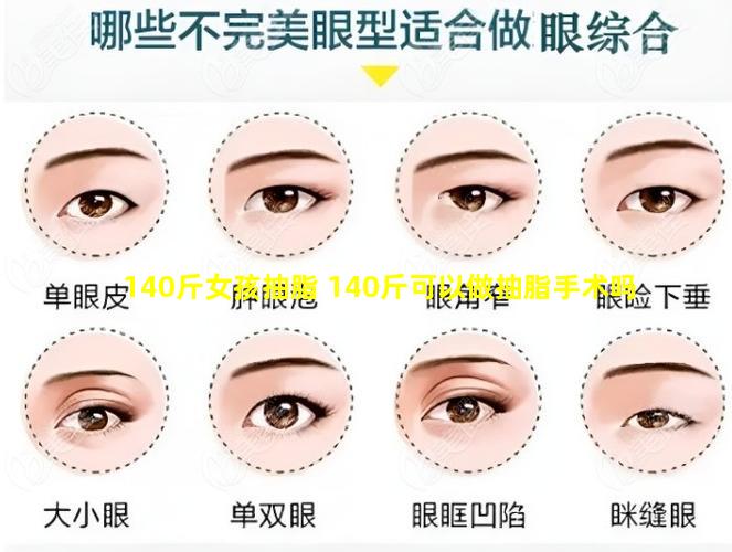 140斤女孩抽脂 140斤可以做抽脂手术吗